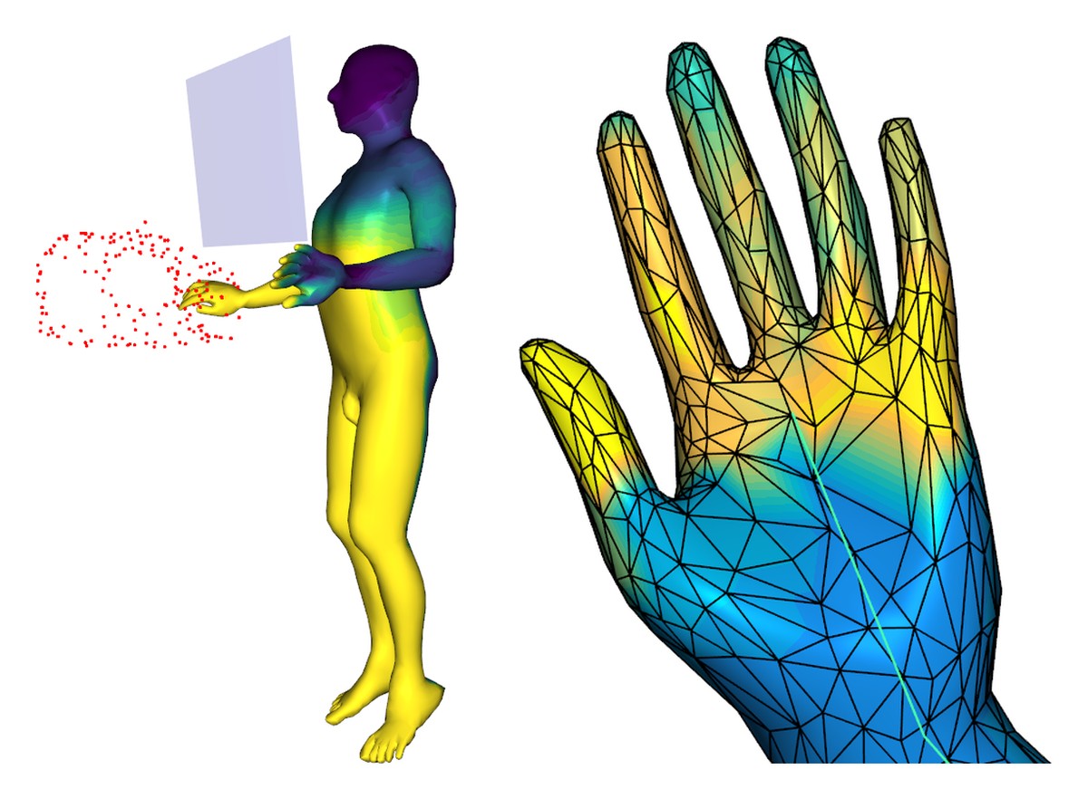 Computed dose distribution on the operator&rsquo;s body and a close-up of the hand, coloured from low to high dose.