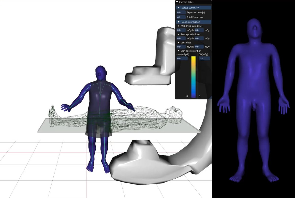IR dose assessment program: a deformable operator phantom beside a C-arm, with live peak skin dose, average skin dose and lens dose readouts.